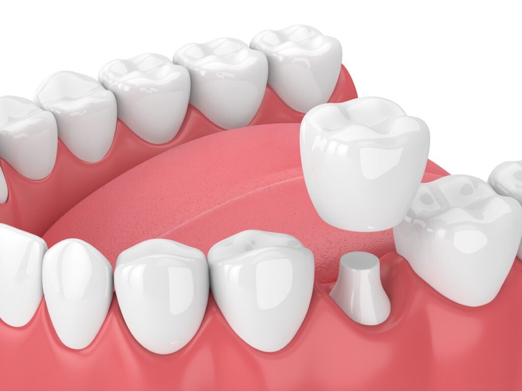 316 Dental -