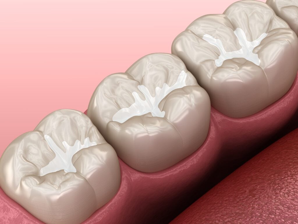 316 Dental -