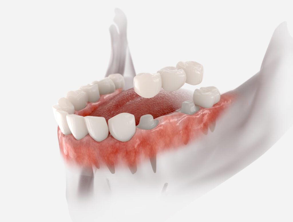 316 Dental -