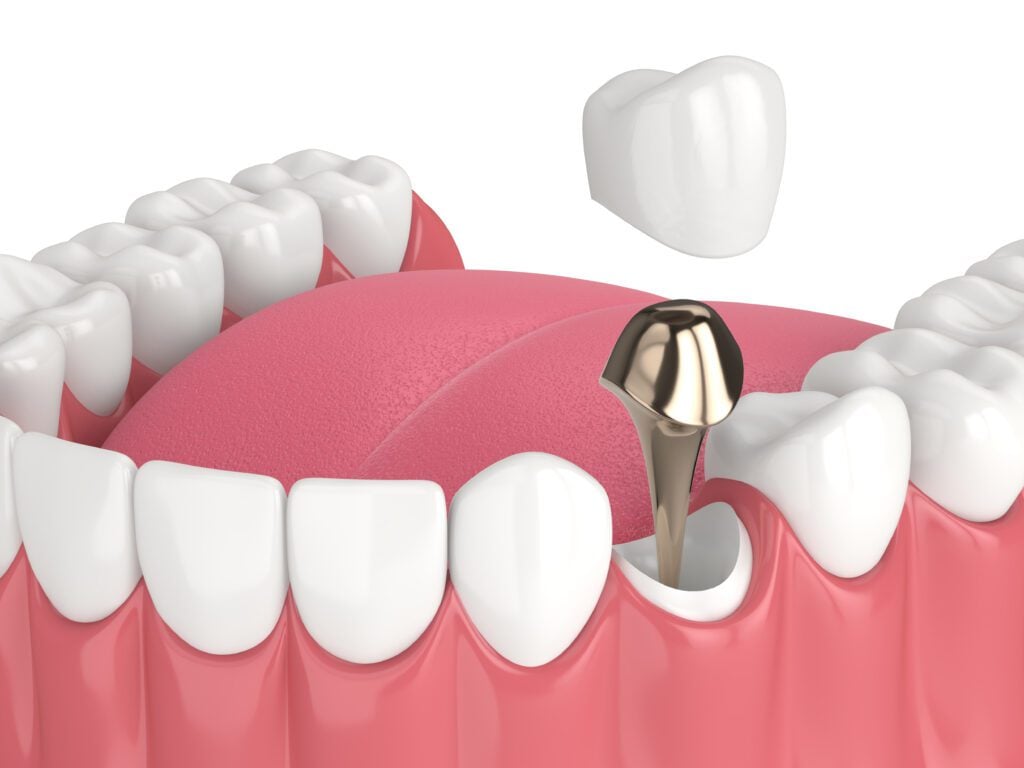 316 Dental -